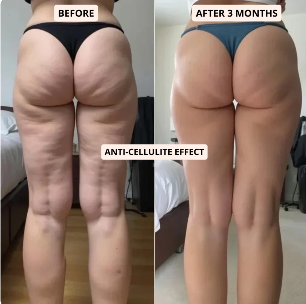 Cellutone™ 3D Legging – Redefine your silhouette effortlessly